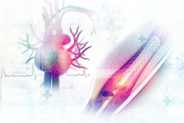 INTERVENTIONAL CARDIOLOGY INTERVENTIONAL CARDIOLOGY